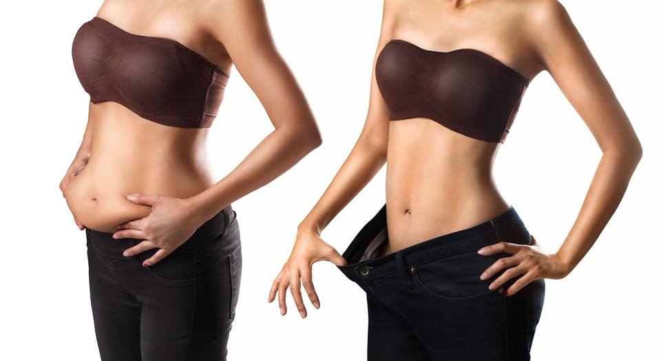 Yağ aldırma (liposuction)