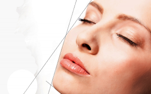 Yüz implantları