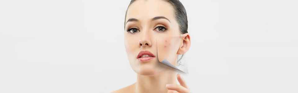 Dermabrazyon..