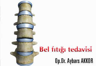 Bel fıtığı tedavisi