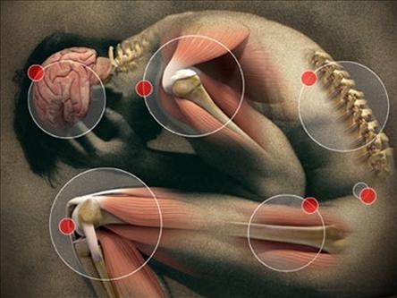 Bel fıtığı nedir ? Nedenleri nelerdir?