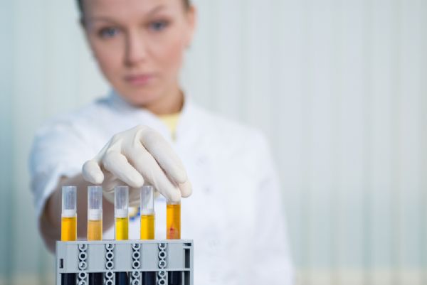 İdrarda protein fazlalığı (proteinüri) makalesi