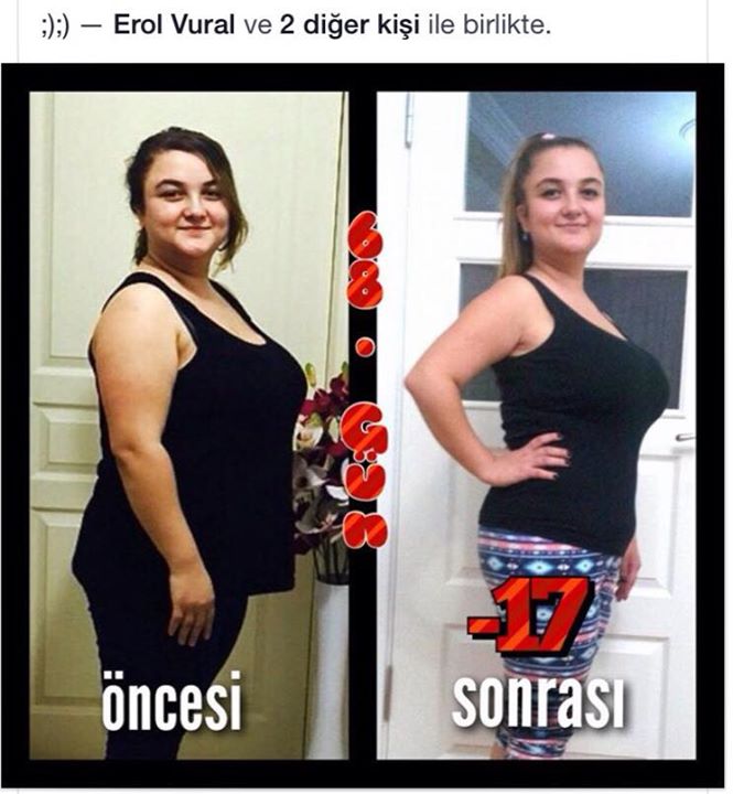 Obezite ve gebelik
