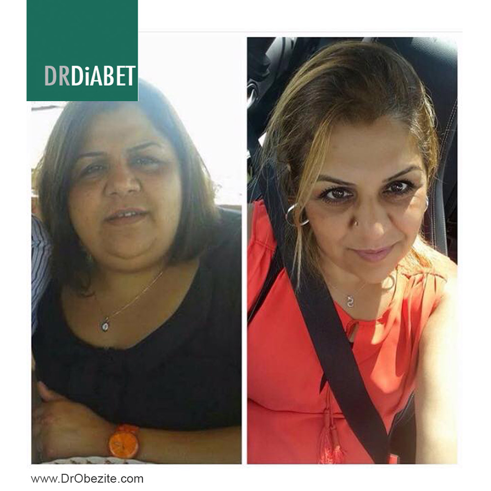 Diyabet ve Depresyon