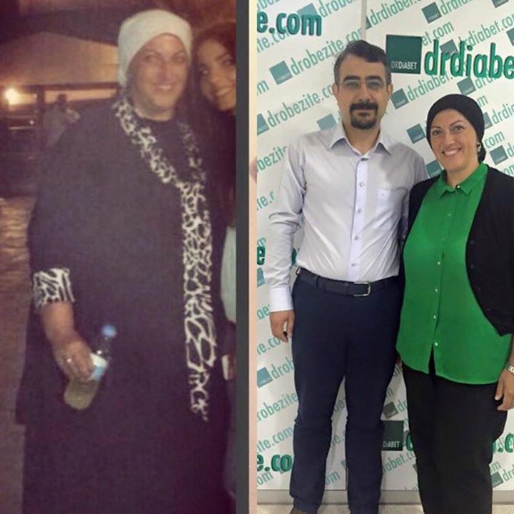 Diyabetin Sınıflandırılması