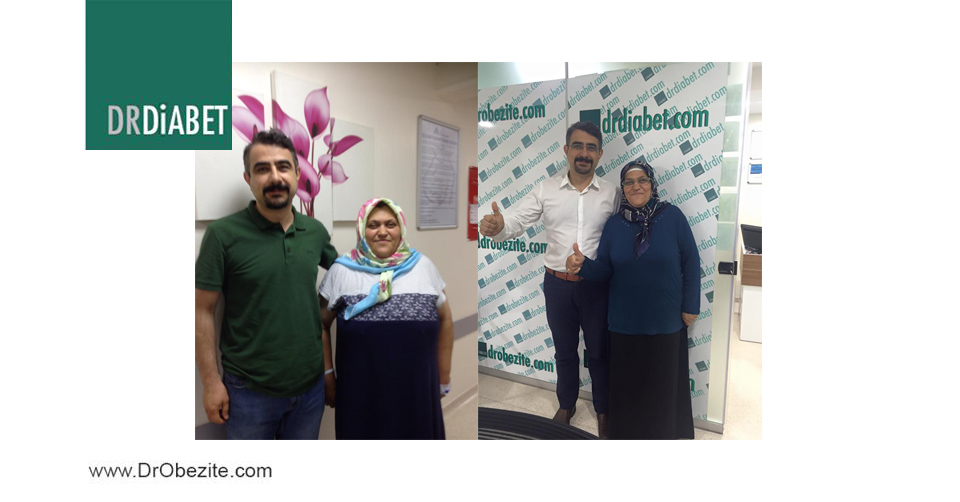 TİP 2 DİYABET Cerrahisi