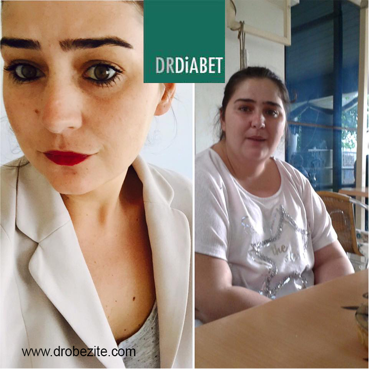 OBEZİTE VE DİABET CERRAHİSİ ÖNCESİ GÖRÜŞMELER NASIL BİR SÜREÇ EŞLİĞİNDE GERÇEKLEŞTİRİLİR?