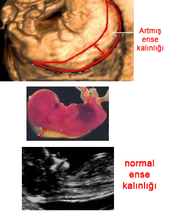İkili Test - Ense Kalınlığı Ölçümü