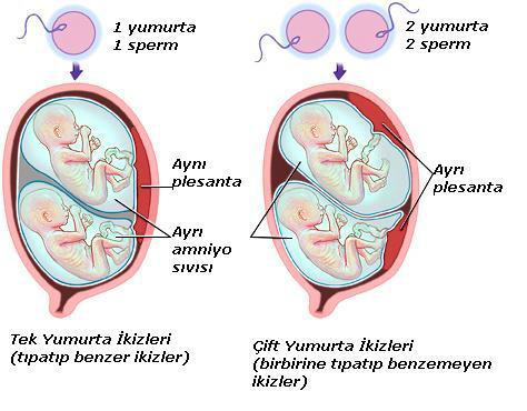 Çoğul ve İkiz Gebelik