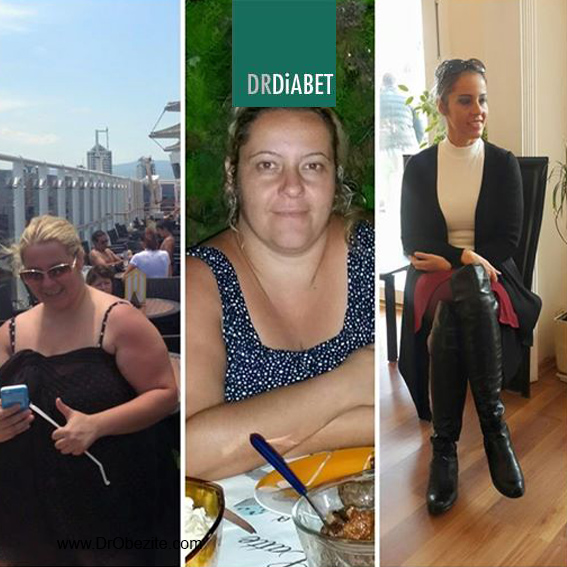 OBEZİTE CERRAHİSİNDE DİYET PSİKOLOJİSİ