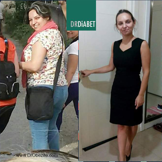 Obezite ve Metabolik Cerrahide beslenme