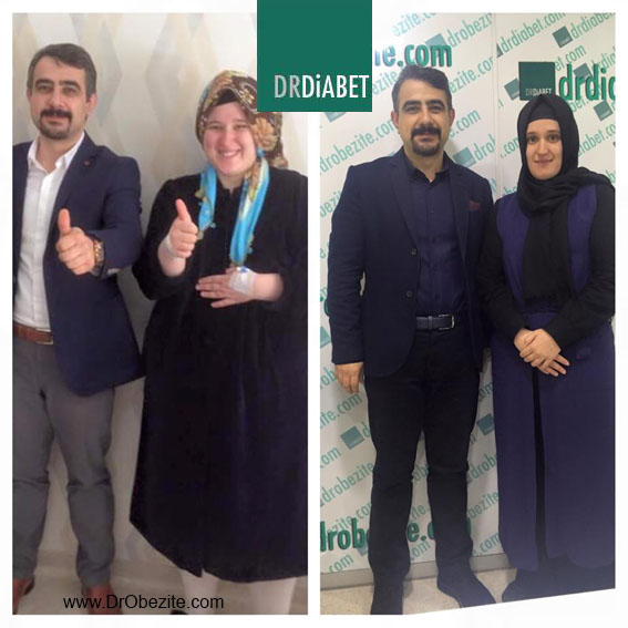 Obezite ve Metabolik Cerrahide bireylerde davranış süreci nasıl açığa çıkar öncelikle buna bir göz atalım..