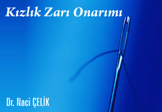Kızlık zarı onarımı