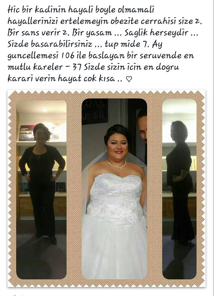 Obezite ve Diyabet’te Kilo Kaybı