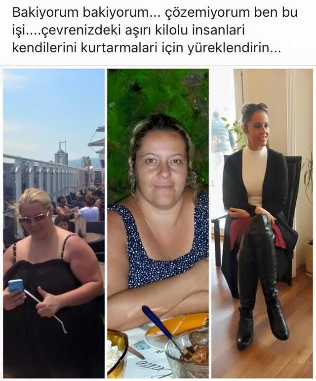Obezite Ameliyatı Sonrası Beslenme Proteinin Önemi