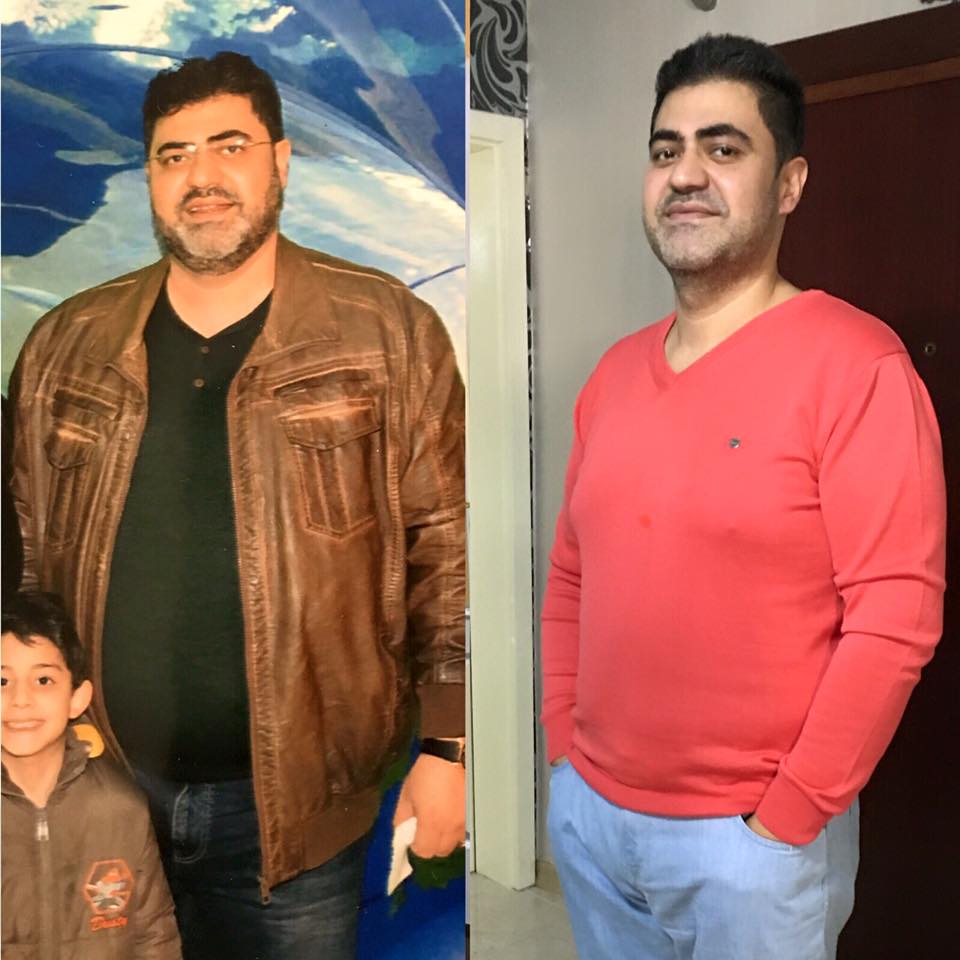Obezite Neden Cinsel Fonksiyon Bozukluğu Yapar?