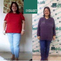 Obezite Cerrahisi Sonrası Yaşanabilecek Sorunlar