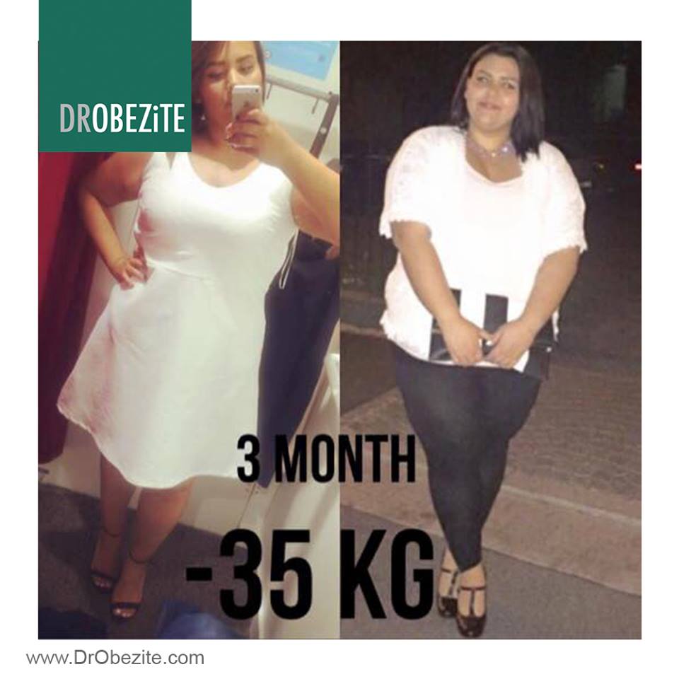 Obezite Cerrahisinde Multidisipliner Yaklaşım