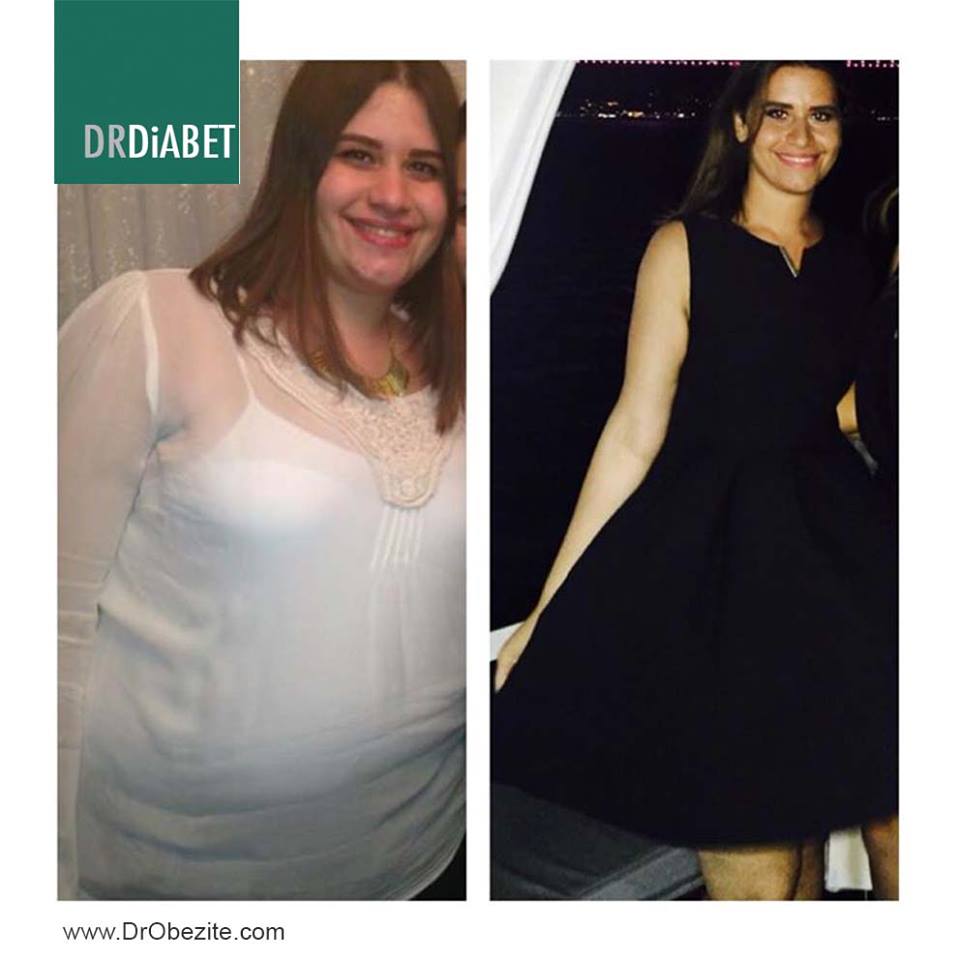 OBEZİTE VE METABOLİK SENDROM