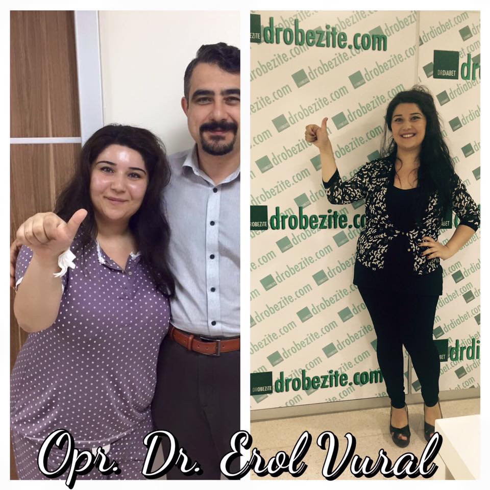 Obezite Ve D Vitamini Arasındaki İlişki