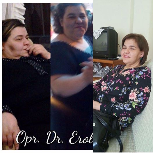Bariatrik Cerrahi Ekibinde Psikoloğun Rolü Nedir?