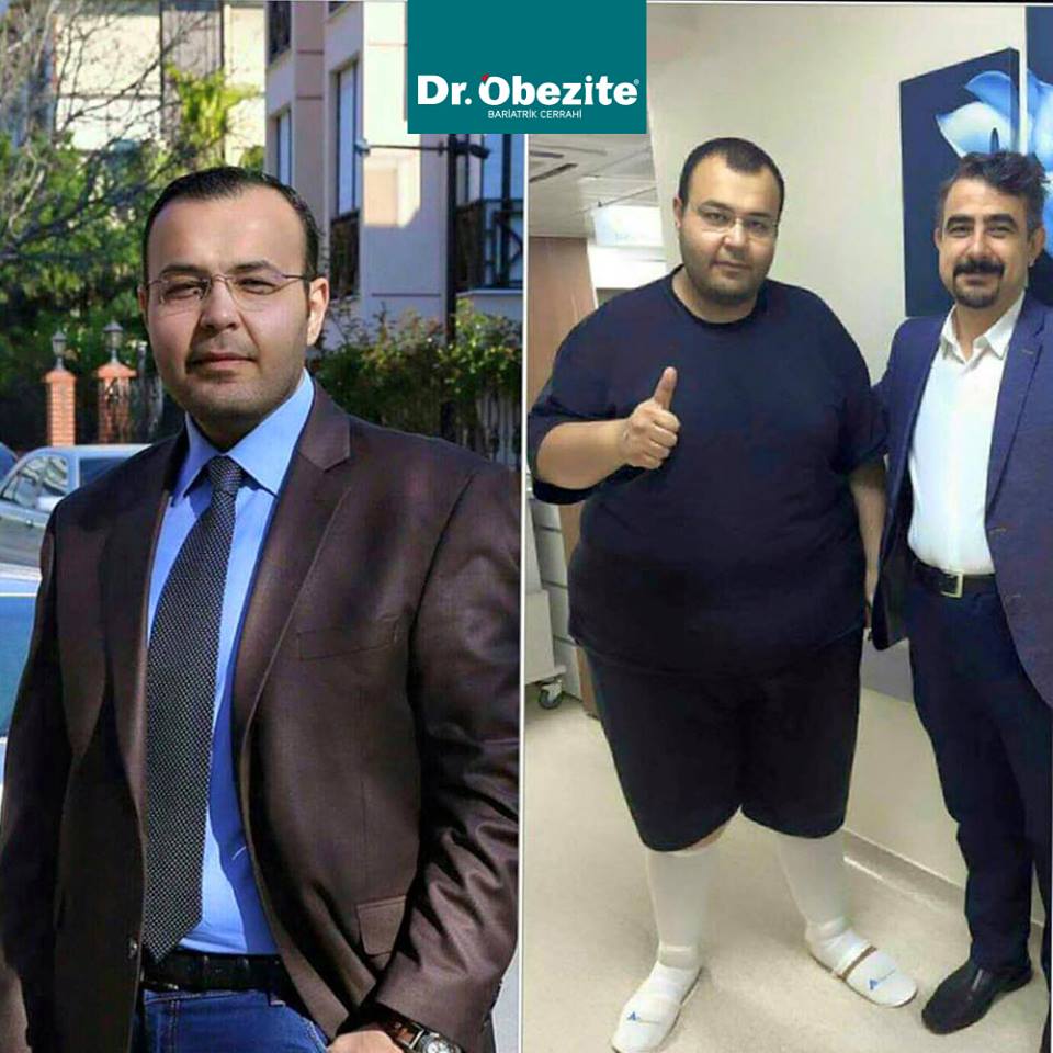 Obezite ve Kanser Arasındaki İlişkideki Biyolojik Mekanizmalar Nelerdir?