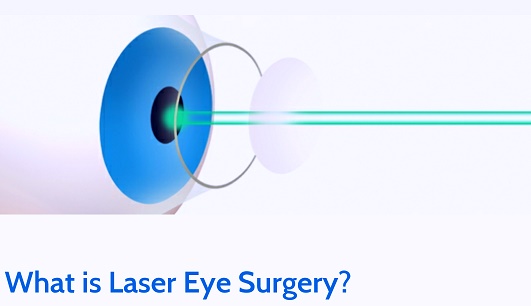 WHAT IS LASER EYE SURGERY?