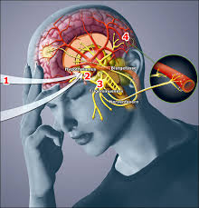 Trigeminal Nevralji nedir?