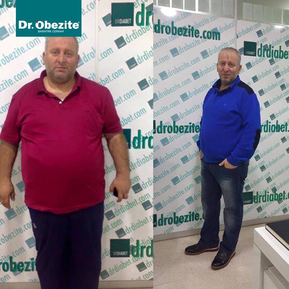 Şişmanlıktan Zayıflık Yolunda Yaşananlar Adım Adım