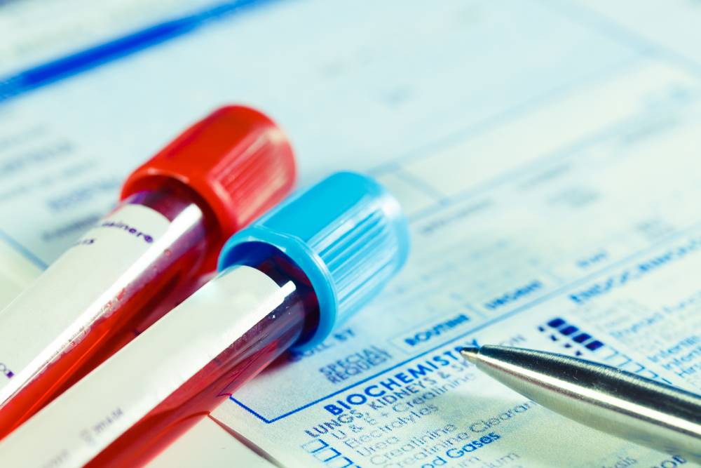 HIV VE ROMATİZMAL HASTALIKLAR