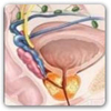 Prostat Kanseri ve Sebepleri nedir? Risk Faktörleri Nelerdir?