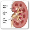 Taş hastalığı nedir? Oluşmasında etkili faktörler nelerdir?