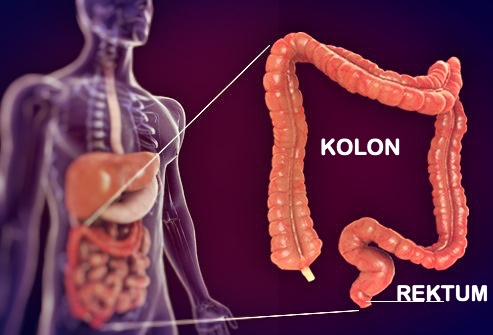 Kolonoskopi nedir? makalesi