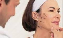 MİNİ YÜZ GERME OPERASYONU ( SHORT SCAR MINI FACE LİFT ) makalesi