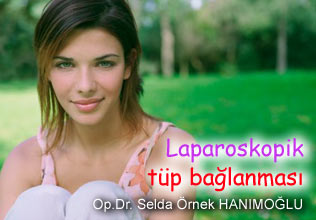 Laparoskopik tüp bağlanması makalesi