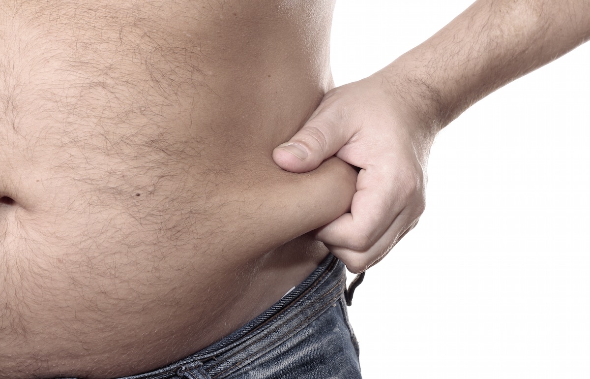 Liposuction Fiyatları