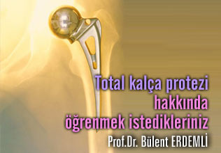 Total kalça protezi hakkında öğrenmek istedikleriniz