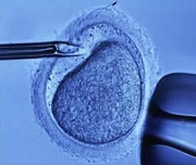 İnfertilite ve Tüp Bebek tedavisi makalesi