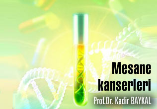 Mesane kanserleri