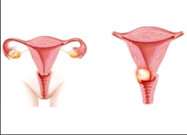 Genital Enfeksiyonlar ve Sebepleri