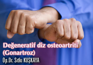 Değeneratif diz osteoartriti (gonartroz) makalesi
