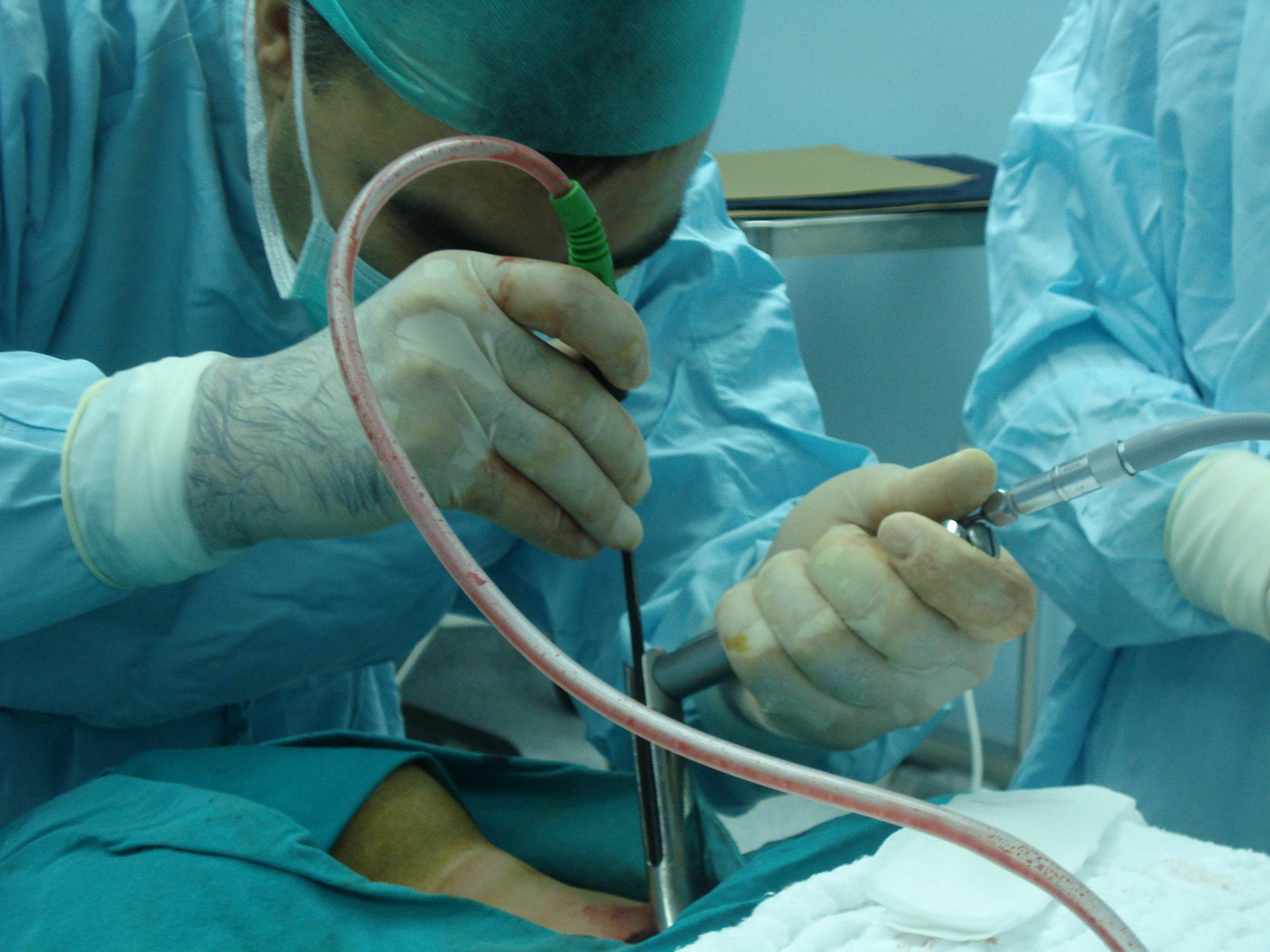 Mediastinal kitleler