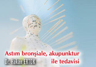 Astım bronşiale , akupunktur ile tedavisi