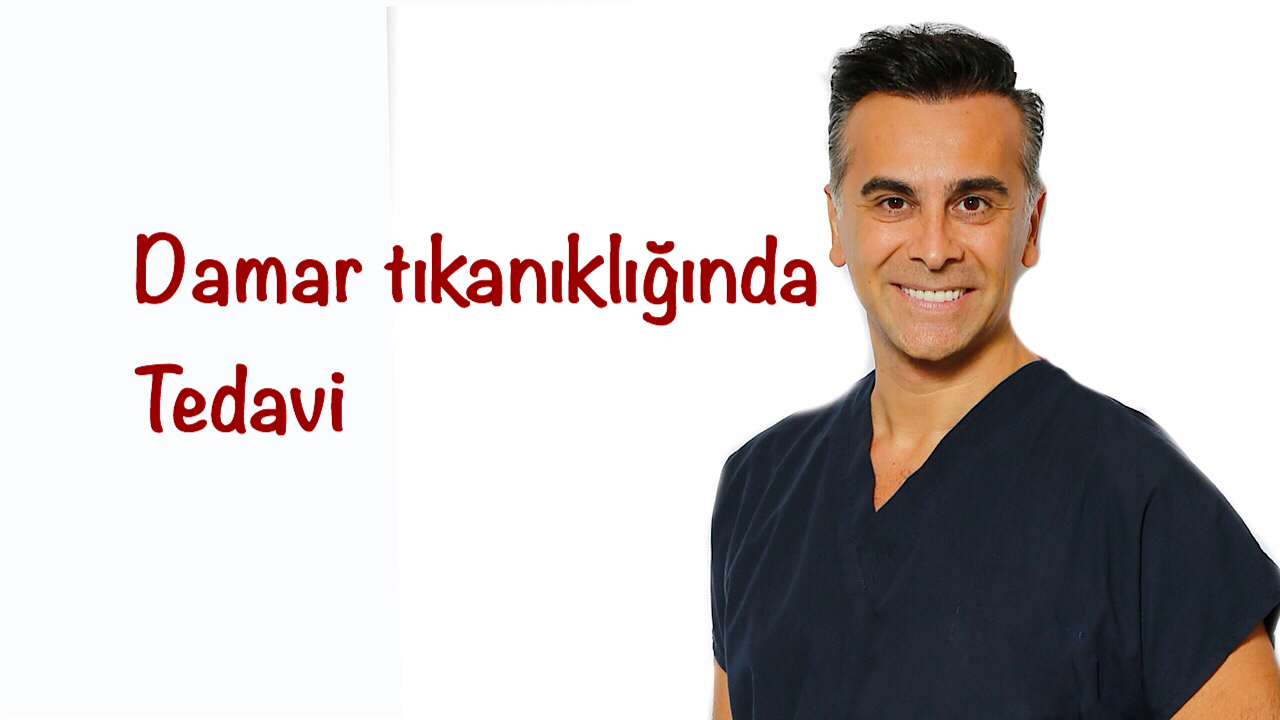 Damar Tıkanıklıkları Her Zaman Açılmalı mıdır?