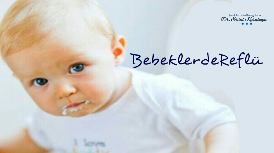 Bebeklerde Reflü makalesi
