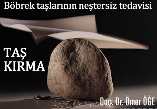 Taş kırma (eswl) - böbrek taşlarının neştersiz tedavisi