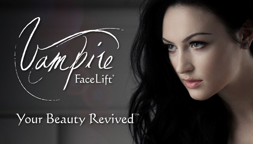 Vampire Facelift
