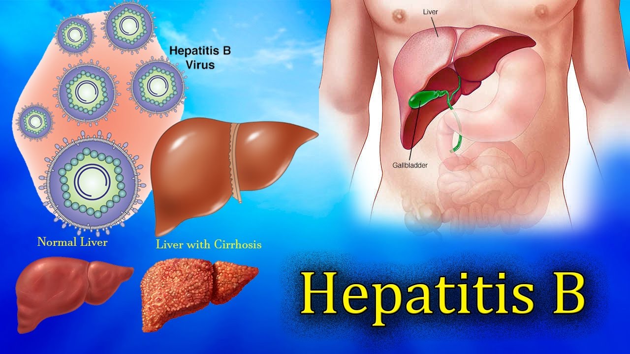 Sinsi Bir Hastalık Hepatitler  Siz de Hepatit Hastası mısınız?