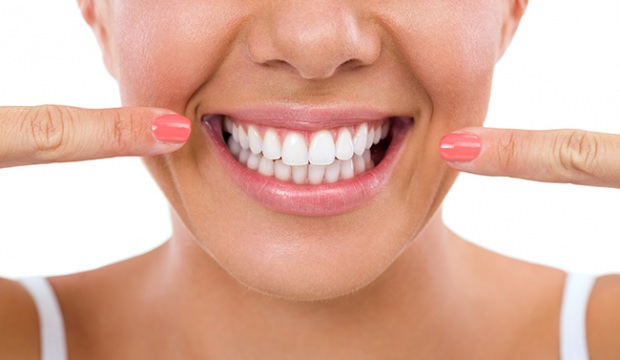 Diş Beyazlatma (Bleaching) ile ilgili en çok sorulan sorular makalesi