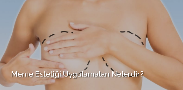 Meme Estetiği Uygulamaları Nelerdir? makalesi
